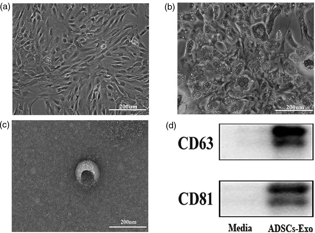 Adipose-derived stem cell exosomes ameliorate traumatic brain injury through the NLRP3 signaling pathway