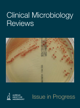 Fungal Endocarditis: Pathophysiology, Epidemiology, Clinical Presentation, Diagnosis, and Management