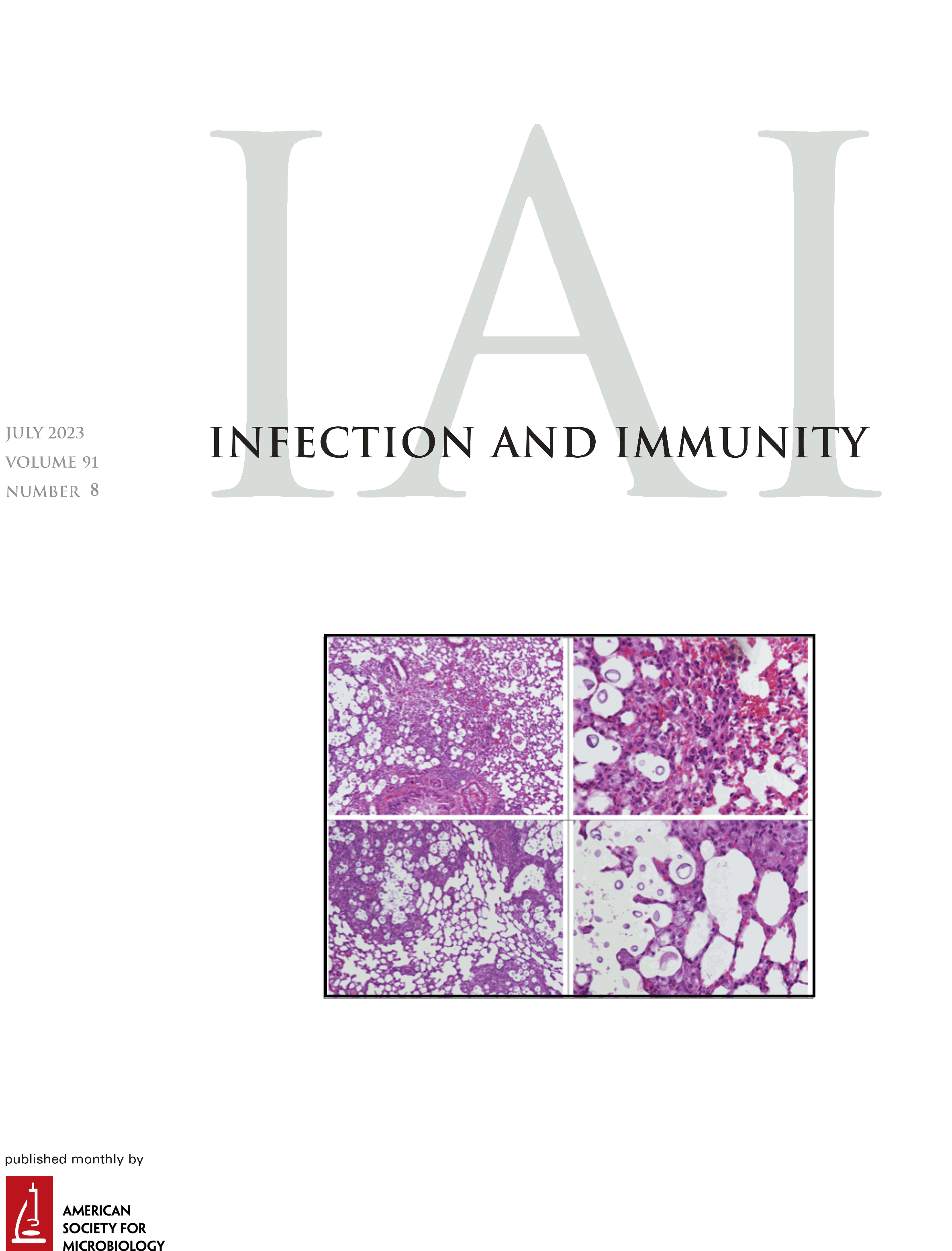 Legionella pneumophila Rhizoferrin Promotes Bacterial Biofilm Formation and Growth within Amoebae and Macrophages