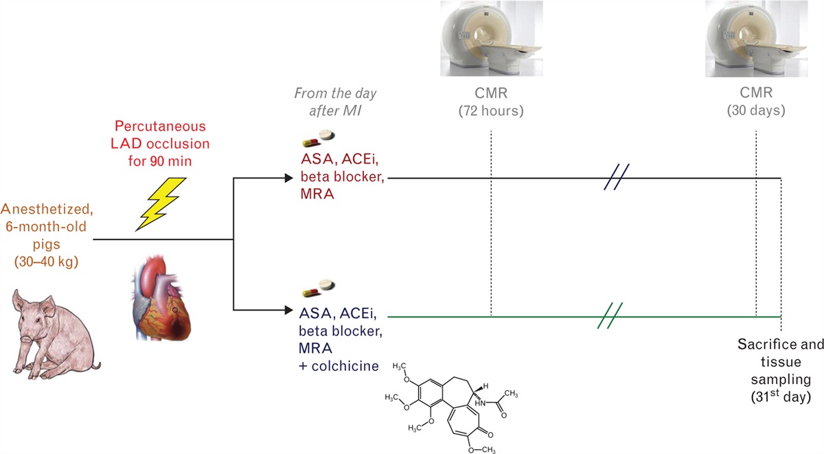 Colchicine added to standard therapy further reduces fibrosis in pigs with myocardial infarction