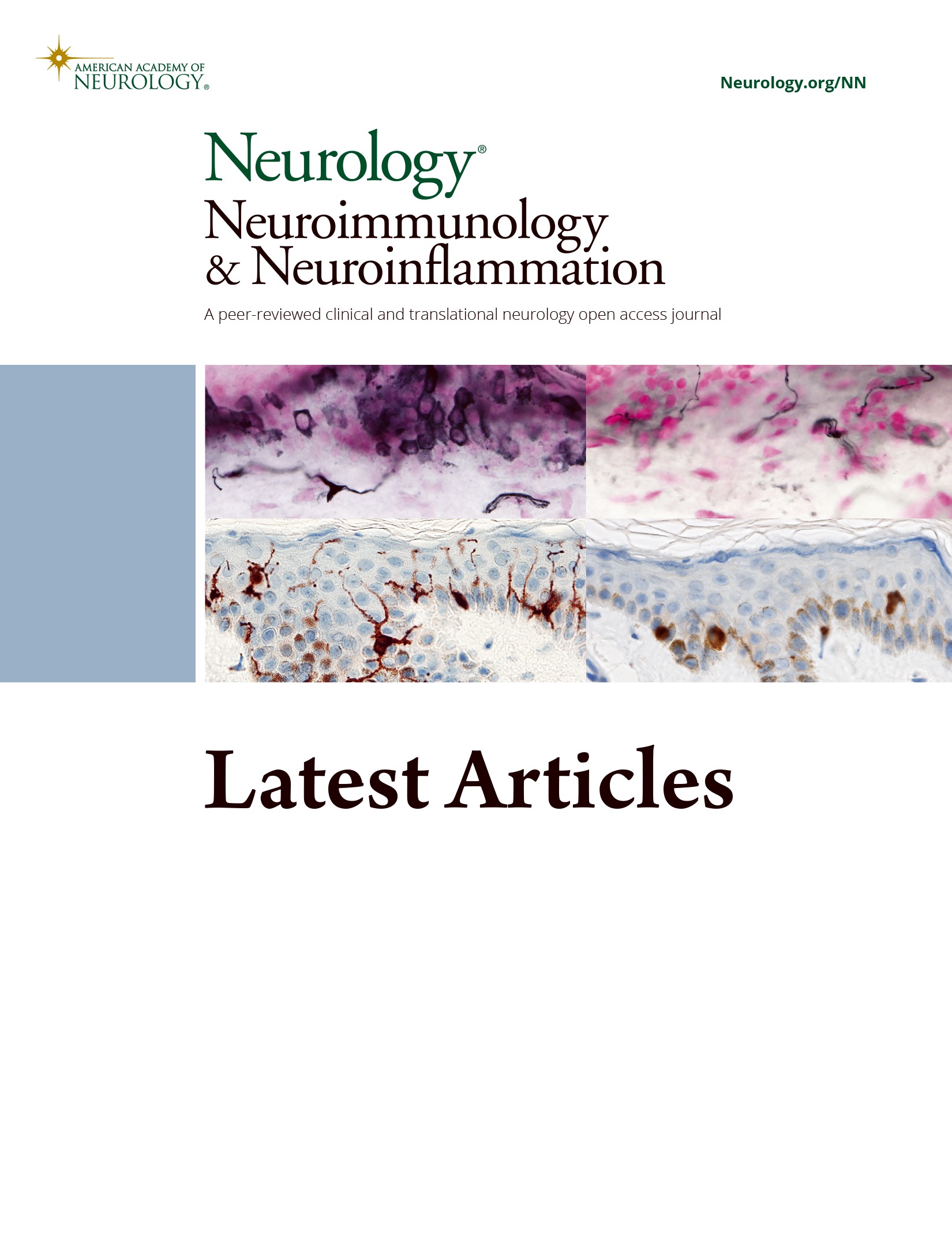 Mitoxantrone in NMO Spectrum Disorder in a Large Multicenter Cohort in French Caribbean