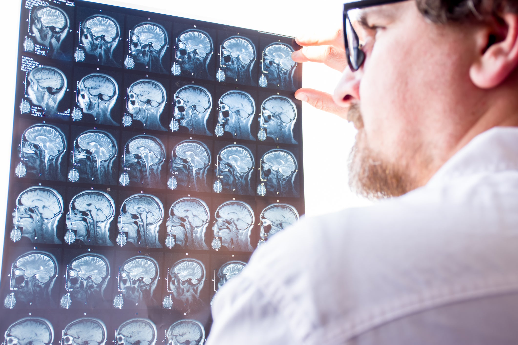 Scientists tame biological trigger of deadly Huntington’s disease