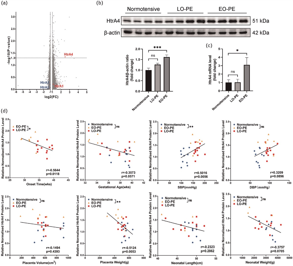 Endoplasmic reticulum stress impairs trophoblast syncytialization through upregulation of HtrA4 and causes early-onset preeclampsia