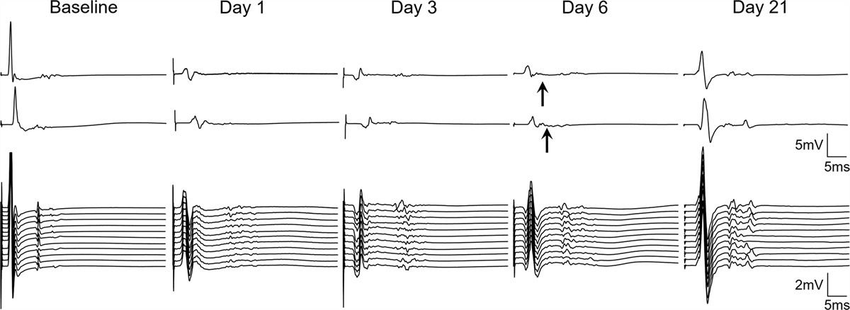 Macrophages are scavengers for injured myelin in a rabbit model of acute inflammatory demyelinating polyneuropathy