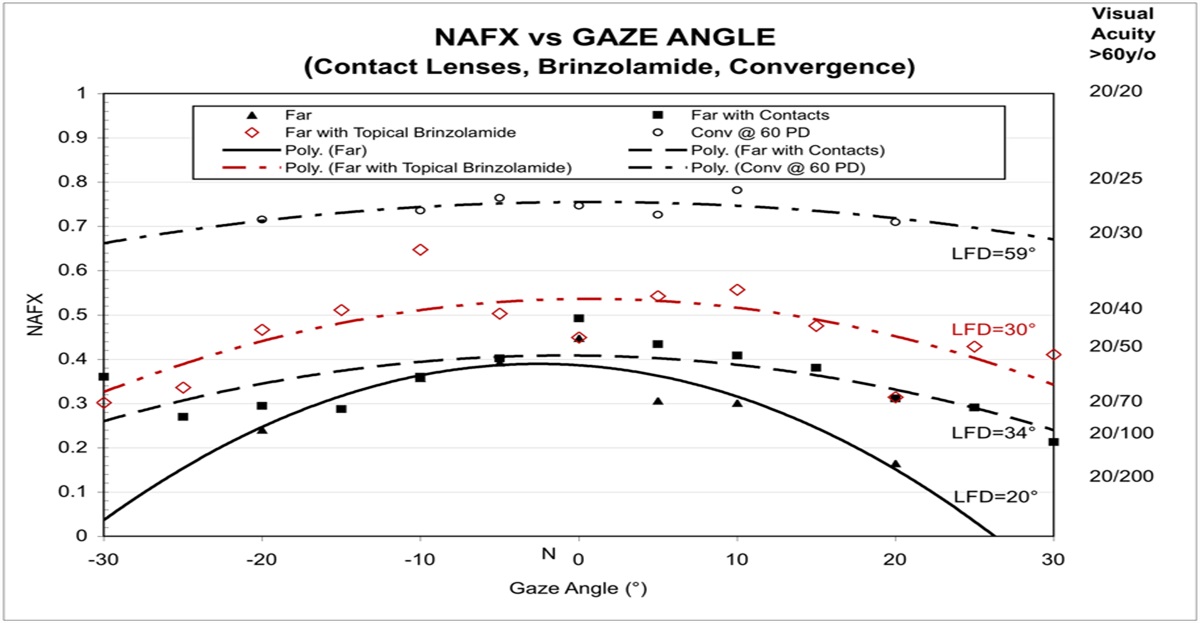 Effects of Topical Brinzolamide on Infantile Nystagmus Syndrome Waveforms: Eyedrops for Nystagmus: Erratum